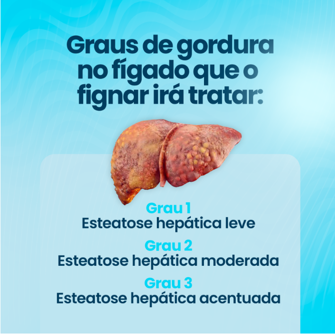 Fignar Gotas Original 30ml - Seu Aliado + Frete Grátis